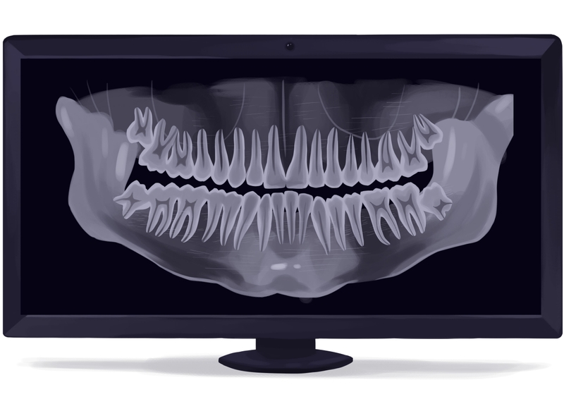 Panoramic dental Xray