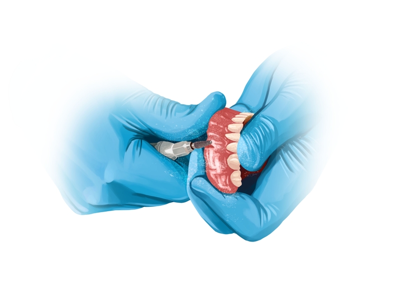 Professional denture adjustment