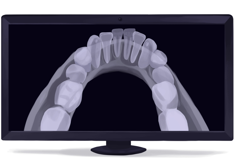 Occlusal dental X-ray