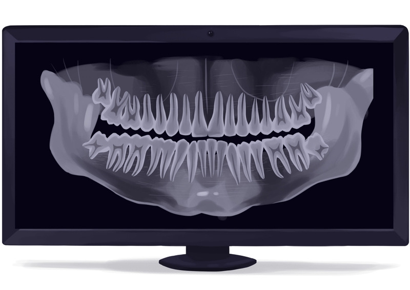 Panoramic dental X-ray