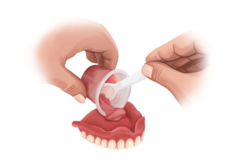 denture reline