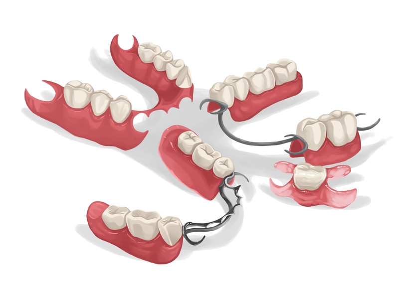 Different tyoes of partials