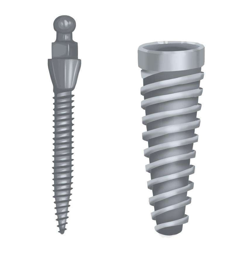 Mini vs. traditional dentalimplant