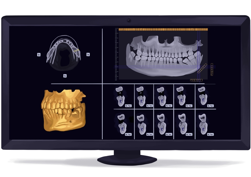 Cone beam CT