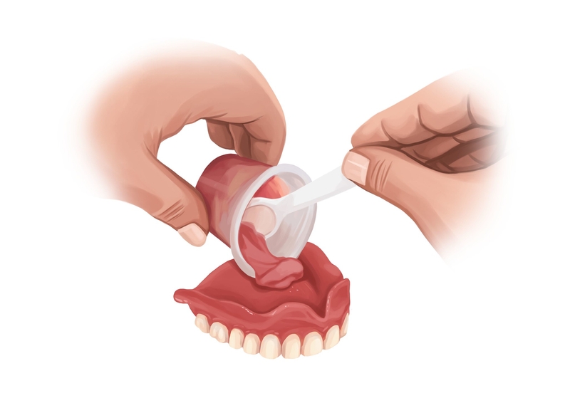 Walk-in local denture repair services