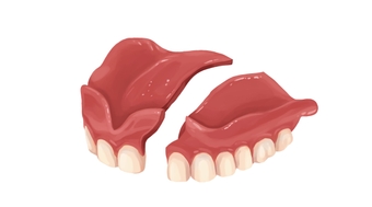 Denture Repair Near Me: Same-Day & Walk-In | Authority Dental