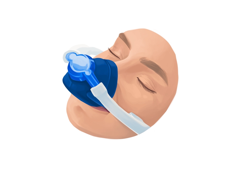 Laughing gas dental anesthesia