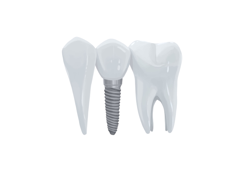 Tooth implant between natural teeth without gums