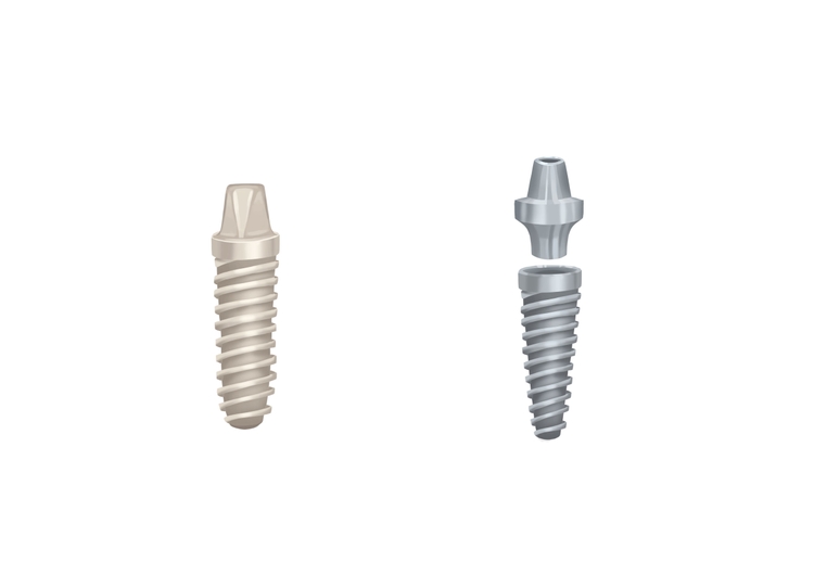 Should you choose zirconia or titanium implants? Authority Dental