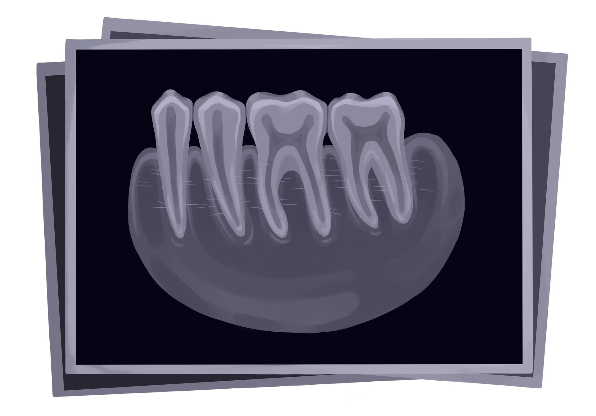 WALK IN EMERGENCY DENTIST In Dayton OH Walk in Dentist Near Me walk-in-emergency-dentist-in-dayton-oh-walk-in-dentist-near-me