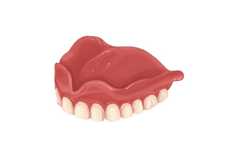 Full upper dentures