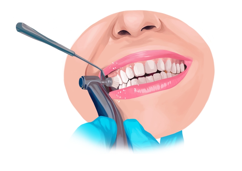 Professional dental cleaning for adults
