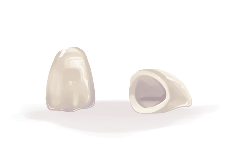 Ceramic dental crown