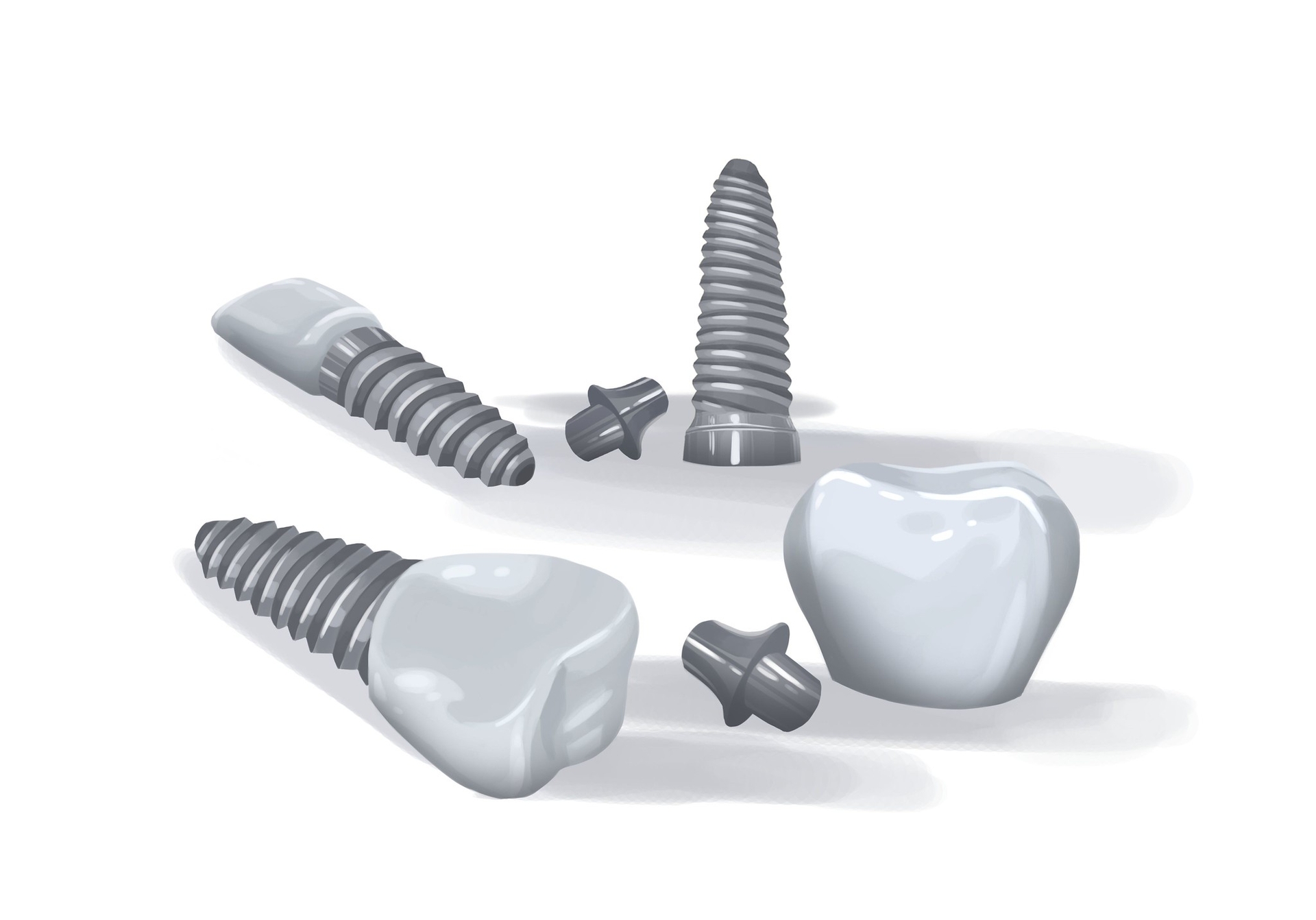 CHEAP DENTIST without insurance in Rochester, NY Cheap dentist near