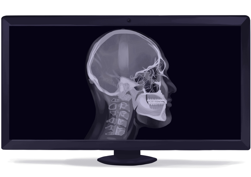 Cephalometric dental X-ray