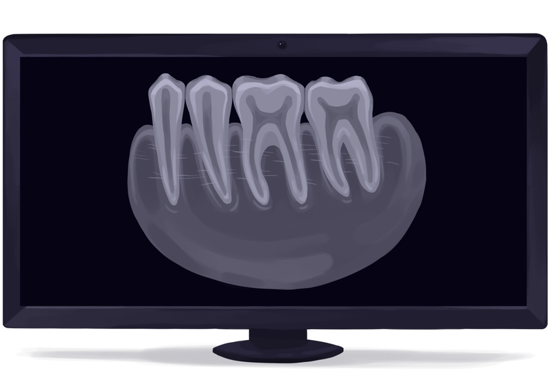 Periapical dental X-ray