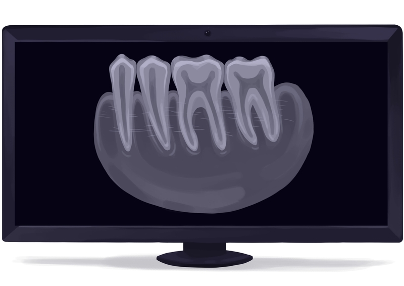 Periapical dental