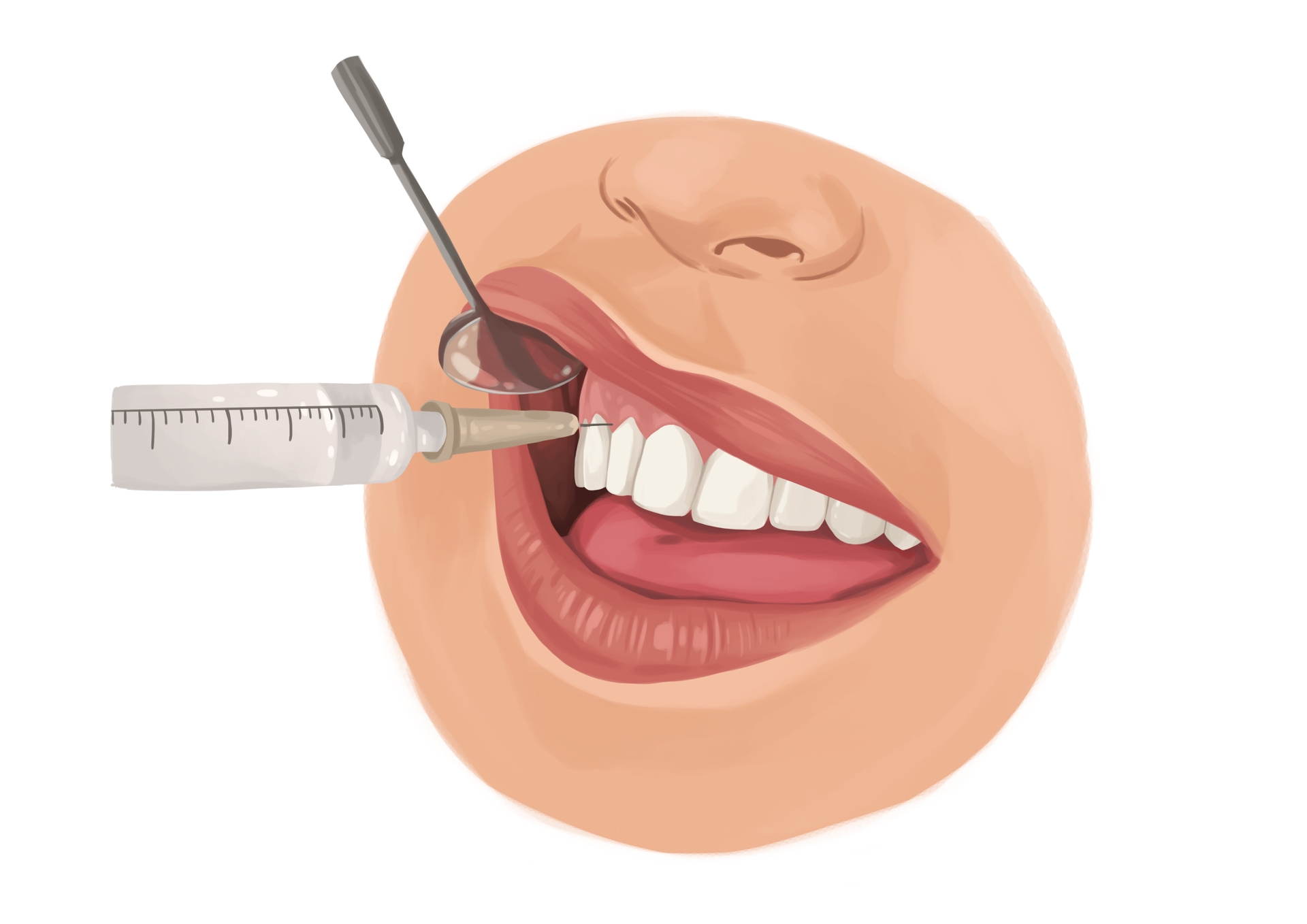 What are the different types of dental anesthesia? Authority Dental