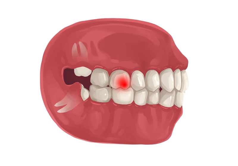 Treatment options for a throbbing tooth pain